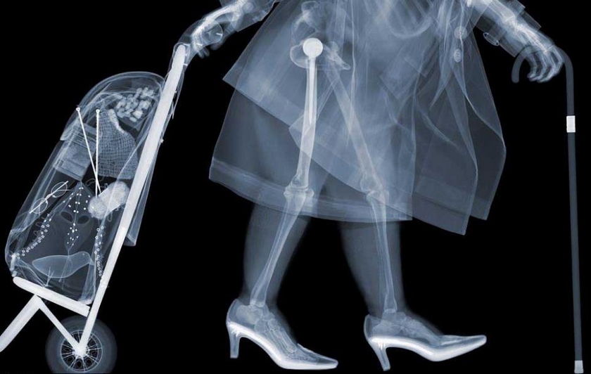 高清：英国艺术家X射线窥视人体 只剩骨架一览无余