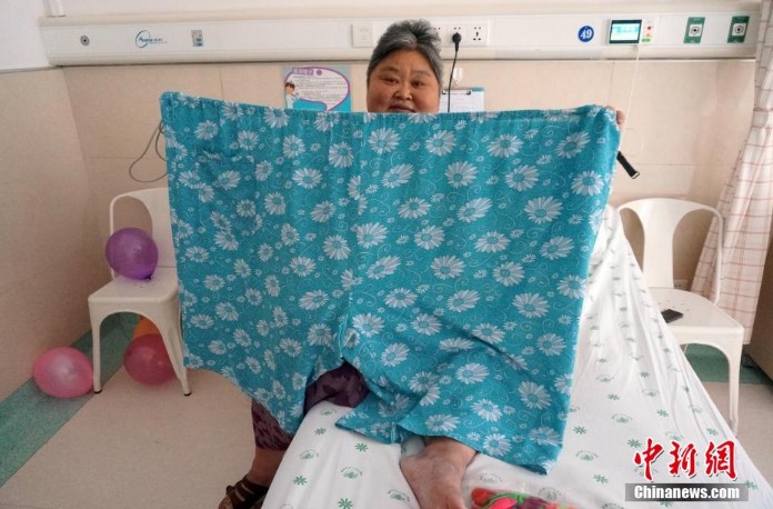 高清:河南350斤重胖姐欲切胃治胖