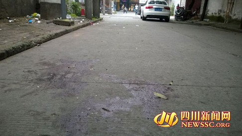 �ɶ����賿���ӽ�ͷ���� Ѫ������������(����)��3��