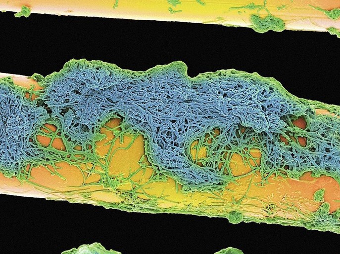 高清:实拍电子显微镜下毛骨悚然的牙齿细菌