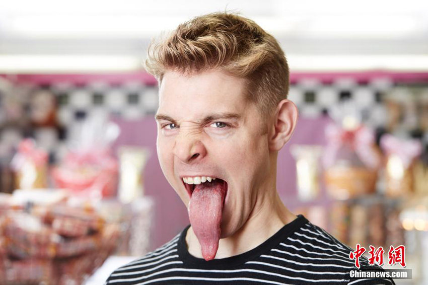ͷ¼Լǵ24Nick Stoeberlͷ10.1סNickǺʱģGene Simmonsͷ㣬һʶԼͷһ˳ܶࡣⳤͷĹעҲҵıӣⲿ